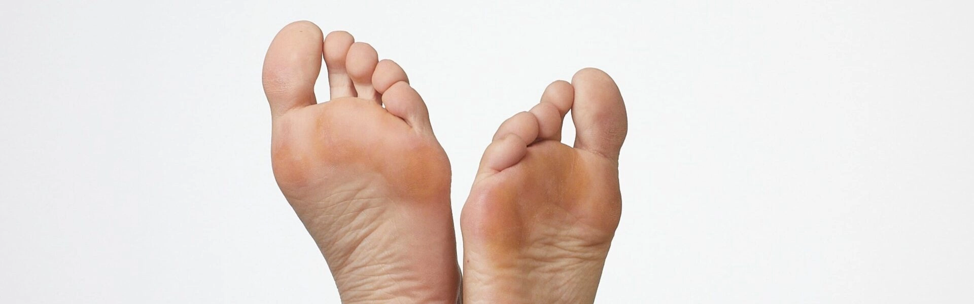 Dry, cracked and calloused skin