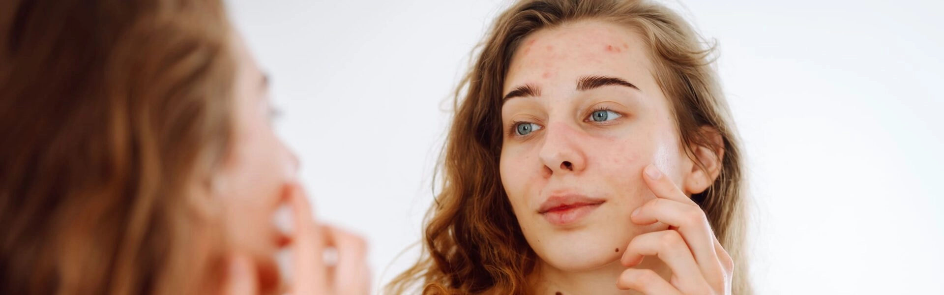 Everything you need to know about the different types of acne and their causes